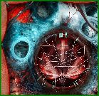 hernia repair www.alaze.us